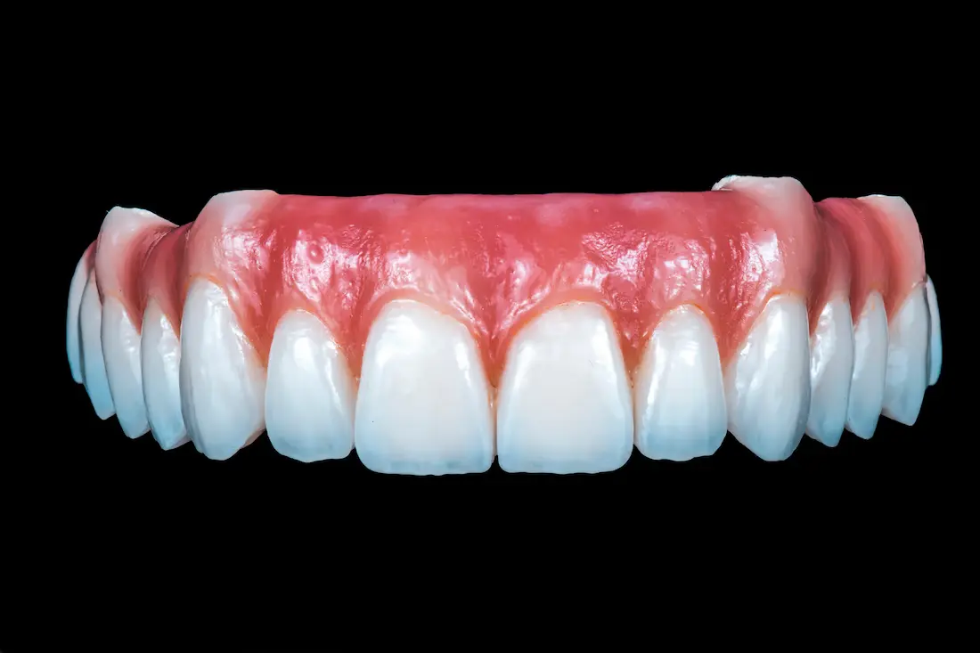 all-on-4-implant-dentures